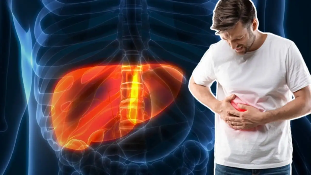 top 3 reasons of fatty liver